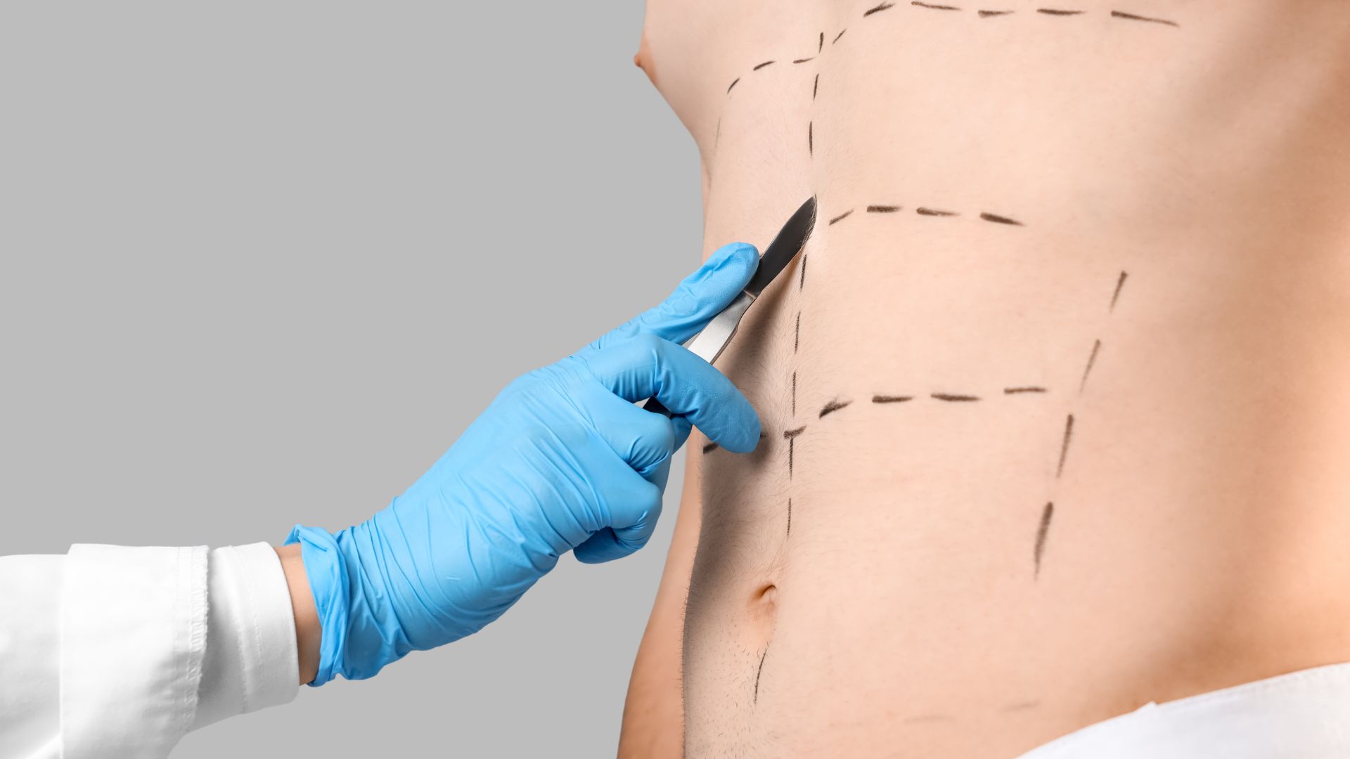 Descubra como viabilizar a cirurgia plástica com planejamento financeiro e opções de parcelamento para realizar seu sonho com segurança.